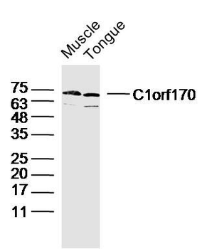 C1orf170 Polyclonal Antibody
