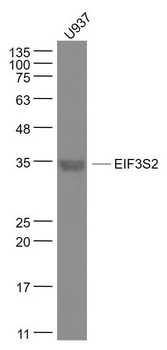 EIF3S2 Polyclonal Antibody