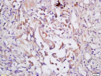 EIF3S2 Polyclonal Antibody