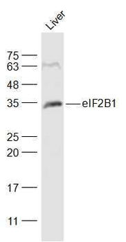 eIF2B1 Polyclonal Antibody