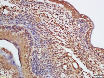 DBR1 Polyclonal Antibody