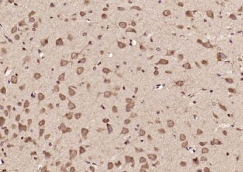 DENND5A Polyclonal Antibody