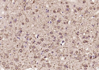 DENND5A Polyclonal Antibody