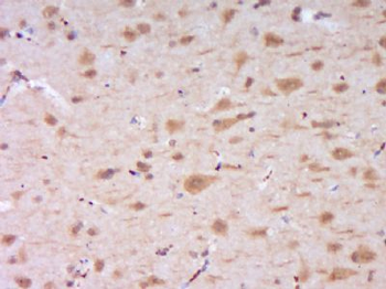 DENND4B Polyclonal Antibody