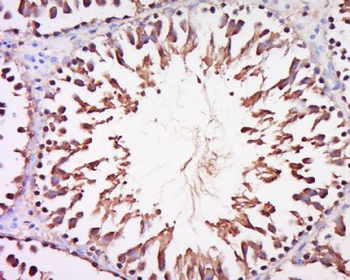 DARS2 Polyclonal Antibody