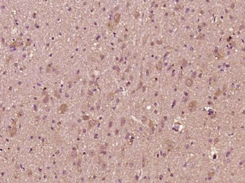 CTTNBP2 Polyclonal Antibody