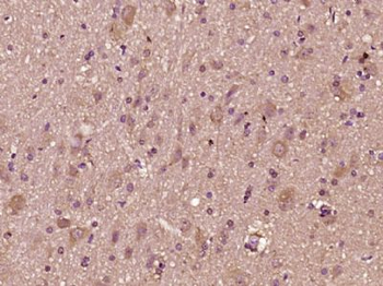 CTTNBP2 Polyclonal Antibody