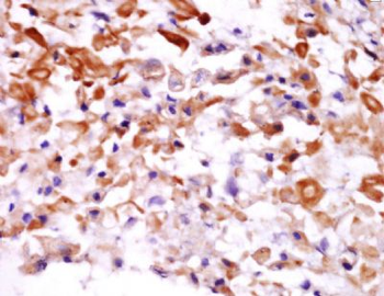 COPZ2 Polyclonal Antibody