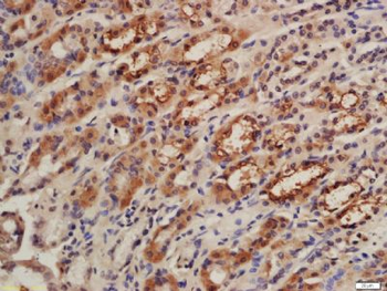 CISD1 Polyclonal Antibody