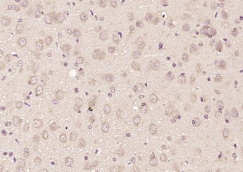 CENPJ Polyclonal Antibody