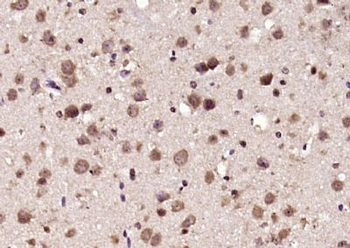 CENPJ Polyclonal Antibody