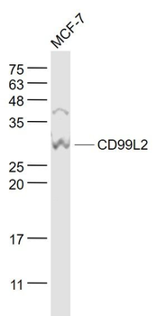 CD99L2 Polyclonal Antibody