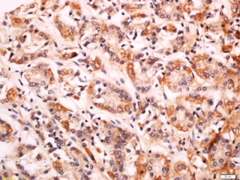 CD99L2 Polyclonal Antibody