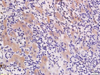 AP1M2 Polyclonal Antibody