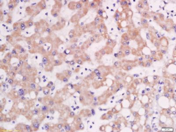 AP1M2 Polyclonal Antibody