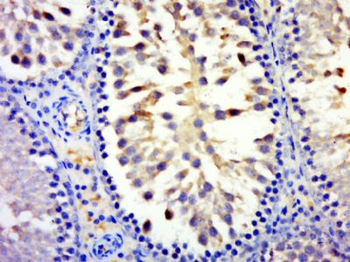 MYCBPAP Polyclonal Antibody