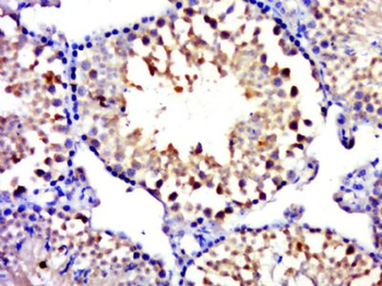 MYCBPAP Polyclonal Antibody