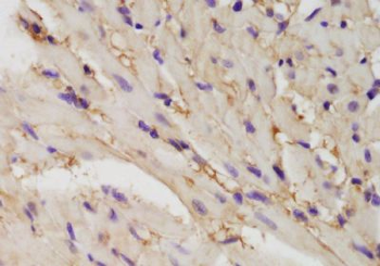 FYCO1 Polyclonal Antibody