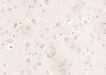 FOPNL Polyclonal Antibody