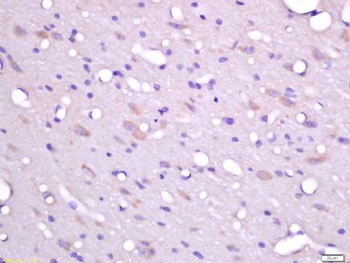 FHOD3 Polyclonal Antibody