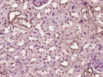 ZNF496 Polyclonal Antibody