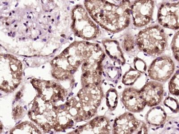 PKD1L2 Polyclonal Antibody