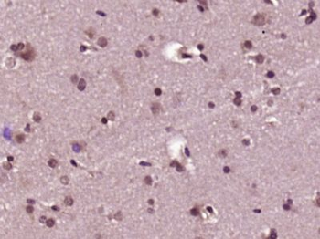 PKD1L2 Polyclonal Antibody