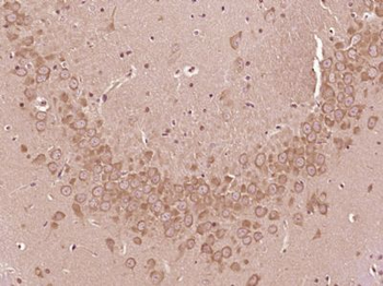 SMEK1 Polyclonal Antibody
