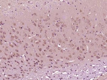 SMEK1 Polyclonal Antibody