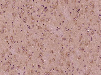 PELI3 Polyclonal Antibody