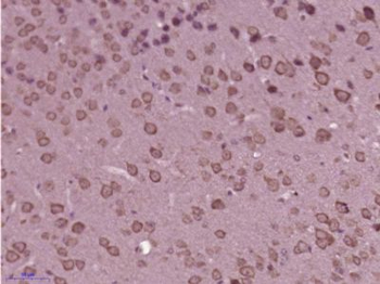 PLEKHG5 Polyclonal Antibody