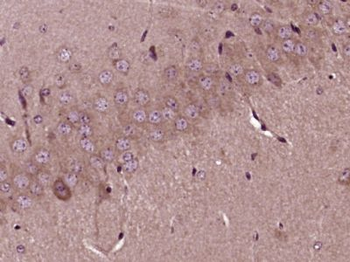 FTSJ1 Polyclonal Antibody