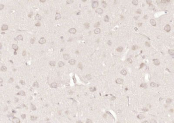 Neurabin 1 Polyclonal Antibody