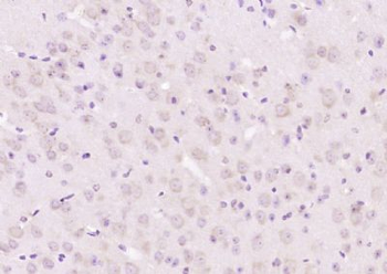 Neurabin 1 Polyclonal Antibody
