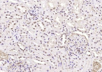 FGGY Polyclonal Antibody