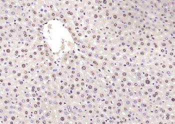 FGGY Polyclonal Antibody