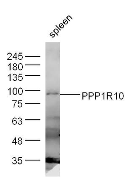 PPP1R10 Polyclonal Antibody