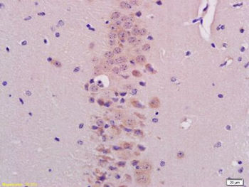 BHLHB9/p60TRP Polyclonal Antibody