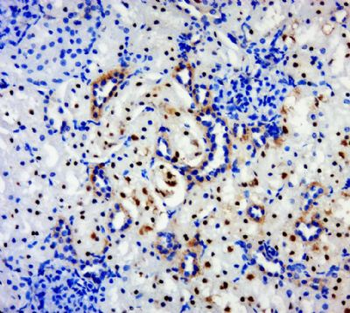 BPTF Polyclonal Antibody