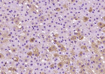 Adrenodoxin Polyclonal Antibody