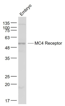 MC4 Receptor Polyclonal Antibody