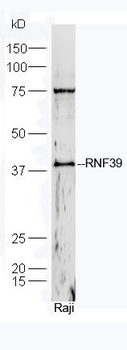 RNF39 Polyclonal Antibody
