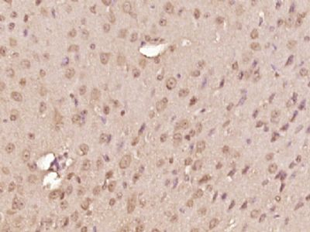 RNF39 Polyclonal Antibody
