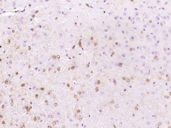 APBA1 Polyclonal Antibody