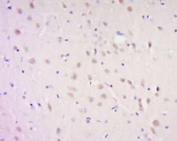 AP180 Polyclonal Antibody