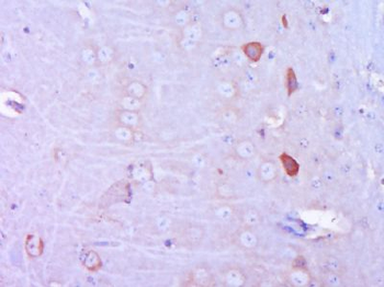 VGLUT1/BNP1 Polyclonal Antibody