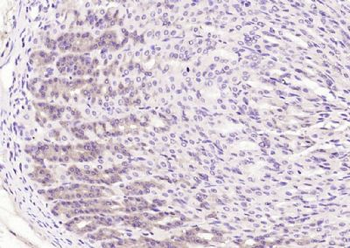 TECTB Polyclonal Antibody