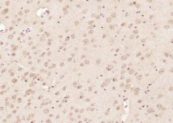 RRAGA + RRAGB Polyclonal Antibody