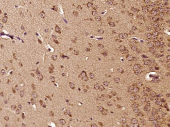 Cathepsin L(heavy chain) Polyclonal Antibody