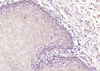 SPINK7 Polyclonal Antibody